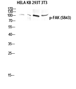 FAK (phospho Ser843) Polyclonal Antibody