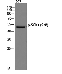 SGK1 (phospho Ser78) Polyclonal Antibody