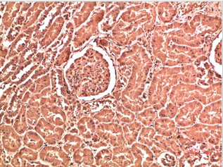 Collagen IV Mouse Monoclonal Antibody(5E10)