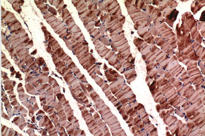 Muscle actin Mouse Monoclonal Antibody(2H3)