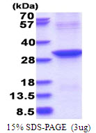 ABHD12B,1-255aa, Human, His tag, E Coli