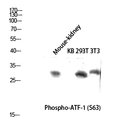 ATF-1 (phospho Ser63) Polyclonal Antibody