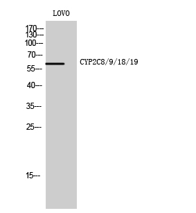 CYP2C8/9/18/19 Polyclonal Antibody