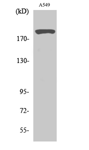 53BP1 Polyclonal Antibody