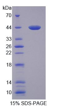 Recombinant A Disintegrin And Metalloproteinase With Thrombospondin 10 (ADAMTS10