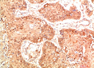 Nrf2 Rabbit Polyclonal Antibody