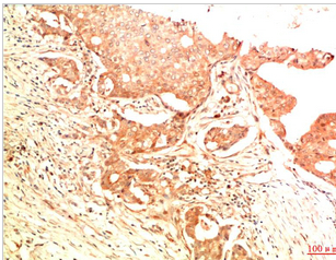 Acetyl P53(K382) Mouse Monoclonal Antibody(5H10)