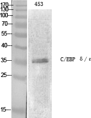 C/EBP ε Polyclonal Antibody