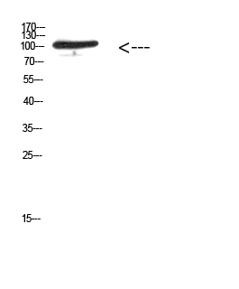 MER/TYRO3 (Phospho-Tyr753/Tyr685) Polyclonal Antibody