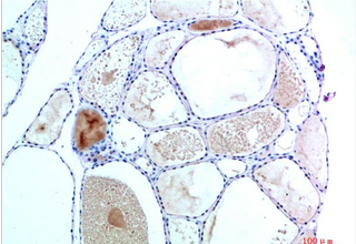 TTR Mouse Monoclonal Antibody(3F2)