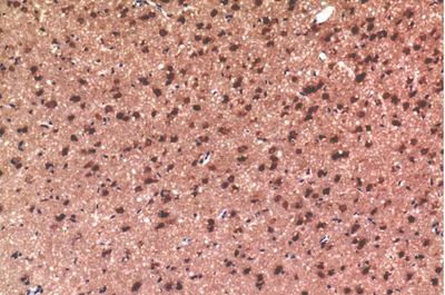 Tau Mouse Monoclonal Antibody(10E3)