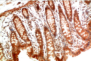 MEK2 Rabbit Polyclonal Antibody