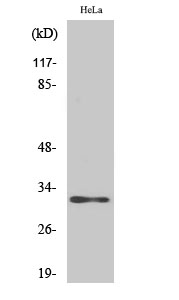 AIG-1 Polyclonal Antibody