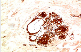 JAK2 Rabbit Polyclonal Antibody