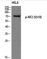 NF2 (phospho Ser518) Polyclonal Antibody
