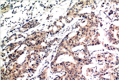 Ubiquitin Mouse Monoclonal Antibody(5F1)