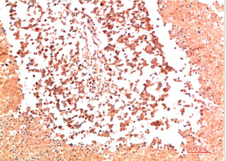 Collagen II Mouse Monoclonal Antibody(9C5)
