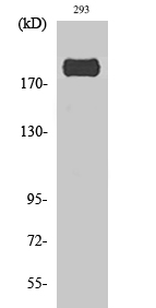 IRS-1 (phospho Ser307) Polyclonal Antibody
