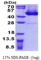 AAGAB, 1-315aa, Human, His tag, E Coli