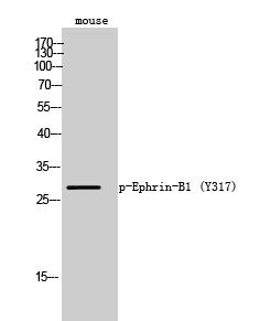 Ephrin-B1 (phospho Tyr317) Polyclonal Antibody