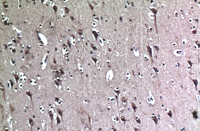 Beclin-1 Mouse Monoclonal Antibody(5C5)