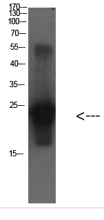 Cystatin C Mouse Monoclonal Antibody(3B12)