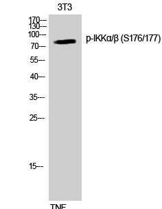 IKKα/β (phospho Ser176/177) Polyclonal Antibody