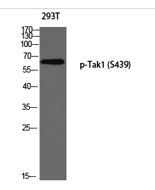 Tak1 (phospho Ser439) Polyclonal Antibody