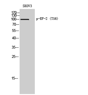 EF-2 (phospho Thr56) Polyclonal Antibody