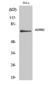 AR-β2 Polyclonal Antibody