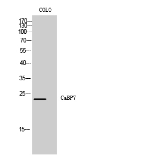 CaBP7 Polyclonal Antibody