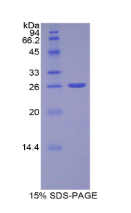 Recombinant A Disintegrin And Metalloprotease 10 (ADAM10)