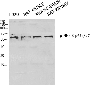 NFκB-p65 (phospho Ser276) Polyclonal Antibody