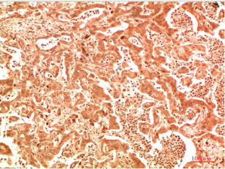 ATG7 Rabbit Polyclonal Antibody