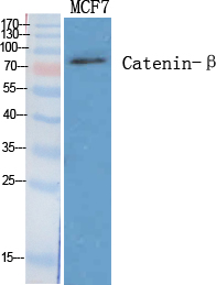 Catenin-β Polyclonal Antibody