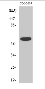 Akt (phospho Thr308) Polyclonal Antibody