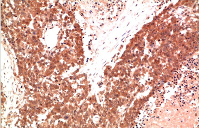 AMPKα1 Mouse Monoclonal Antibody(9G3)