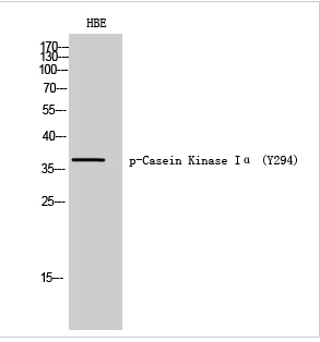 Casein Kinase Iα (phospho Tyr294) Polyclonal Antibody