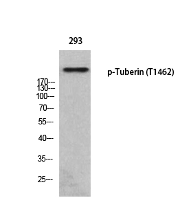 Tuberin (phospho Thr1462) Polyclonal Antibody