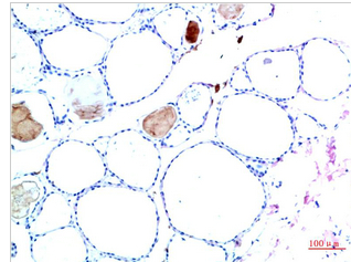 TTR Mouse Monoclonal Antibody(10H2)