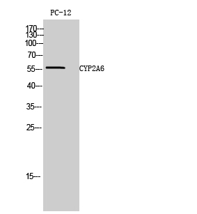 CYP2A6 Polyclonal Antibody