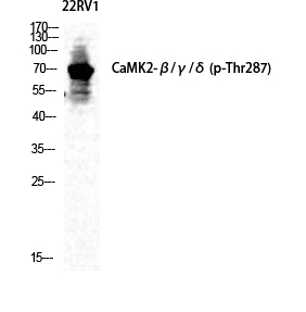 CaMKIIβ/γ/δ (phospho Thr287) Polyclonal Antibody
