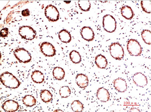 Collagen I Mouse Monoclonal Antibody(5B7)
