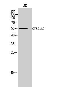 CYP21A2 Polyclonal Antibody
