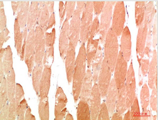WIPI2 Rabbit Polyclonal Antibody