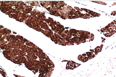 Muscle actin Mouse Monoclonal Antibody(1E9)