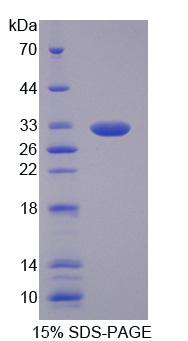 Recombinant Absent In Melanoma 1 (AIM1)