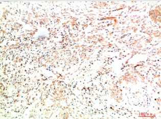 Collagen II Mouse Monoclonal Antibody(8F6)