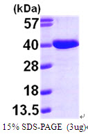 AASDHPPT, 14-309aa, Human, His tag, E Coli