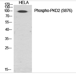 PKD2 (phospho Ser876) Polyclonal Antibody
